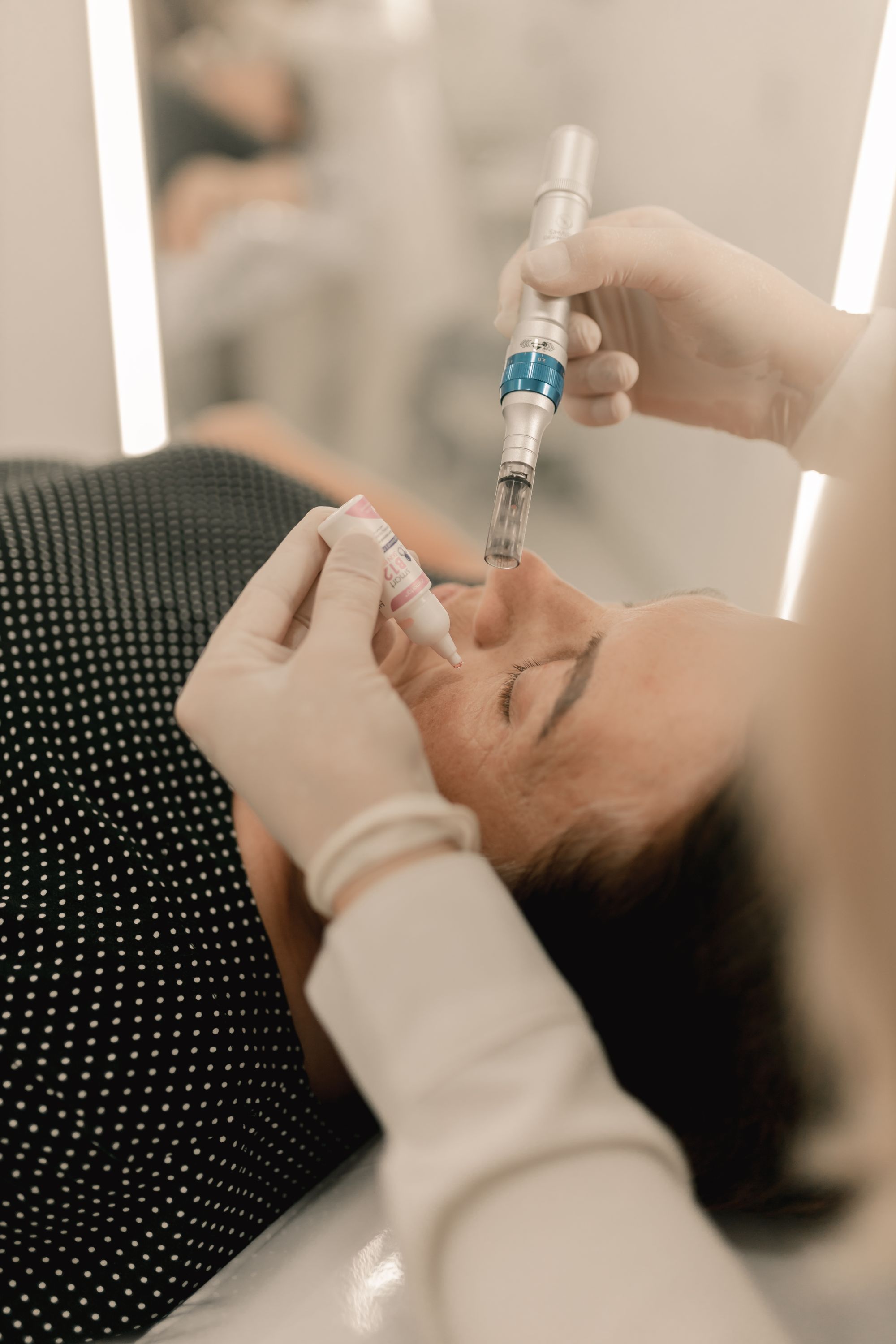 Procedimiento profesional con Dermapen